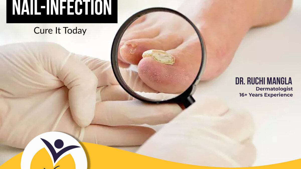 Nail Infection Treatment in Punjab - Vasu Eye Institute & Skin Centre