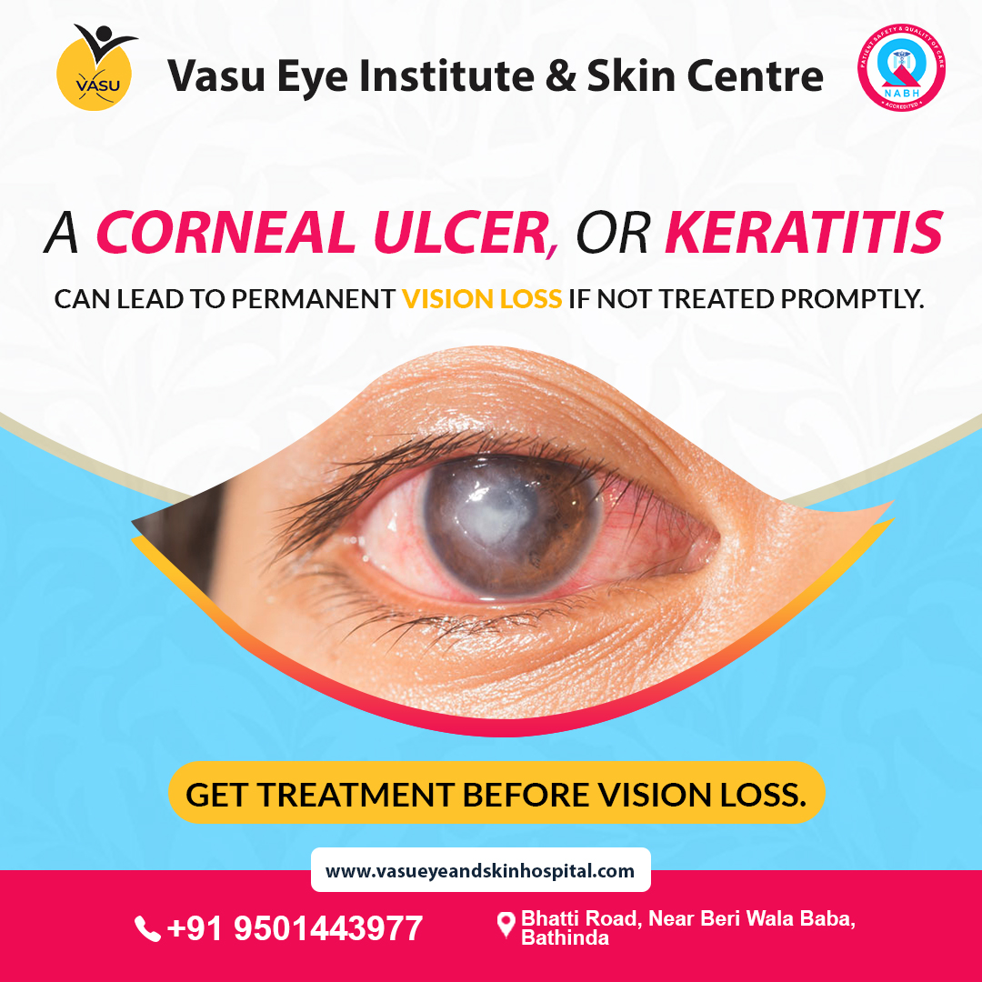 Take care of your cornea with specialized eye care by experts at Best Eye Hospital in Bathinda