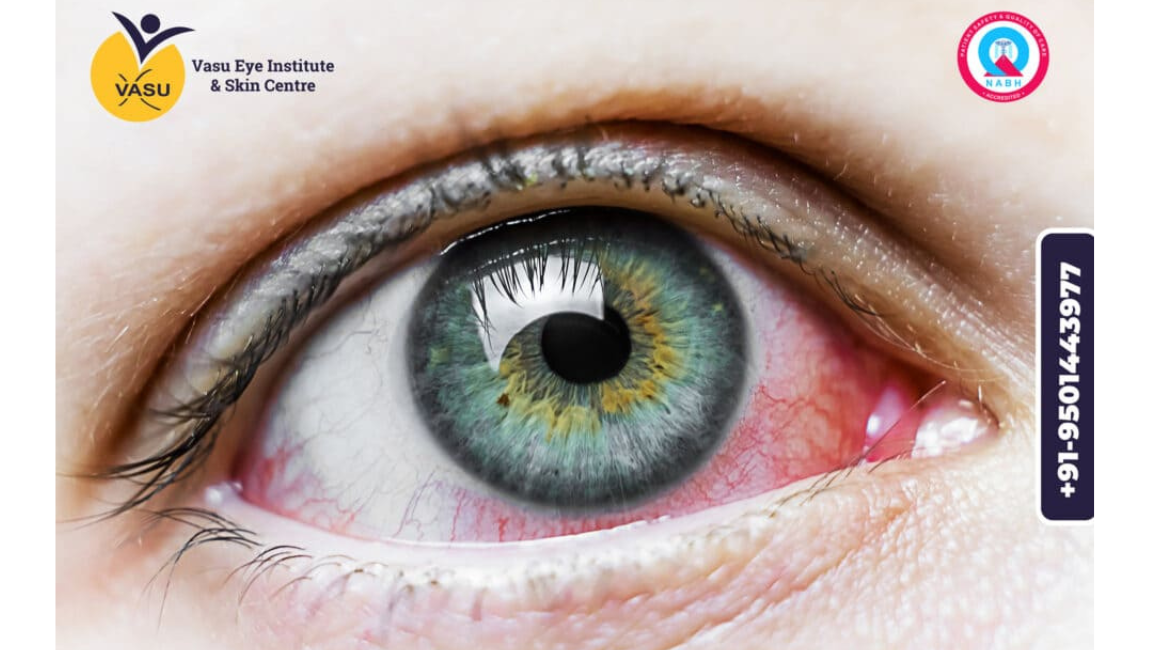 Best Retina Hospital in Bathinda