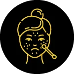 Acne (pimples) Treatment