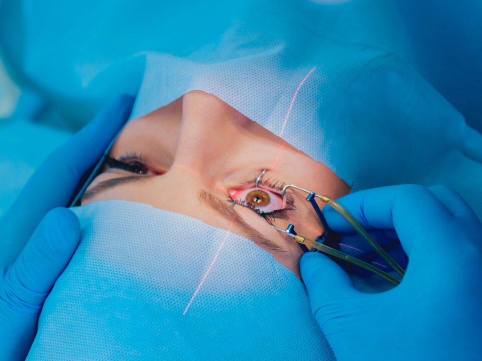 Laser vision correction. A patient and team of surgeons in the operating room