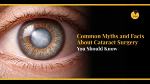 Common Myths and Facts About Cataract Surgery You Should Know