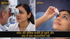 ब्लेड-फ्री लेसिक सर्जरी से पहले और बाद में क्या सावधानियाँ रखें