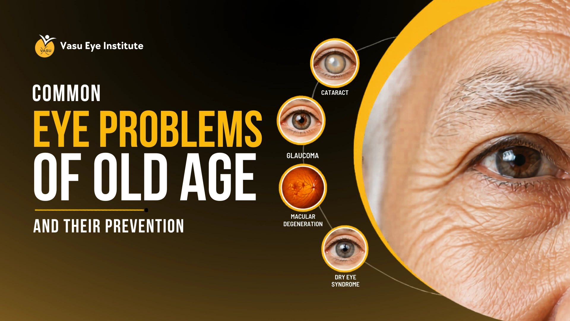 Common Eye Problems of Old Age and Their Prevention