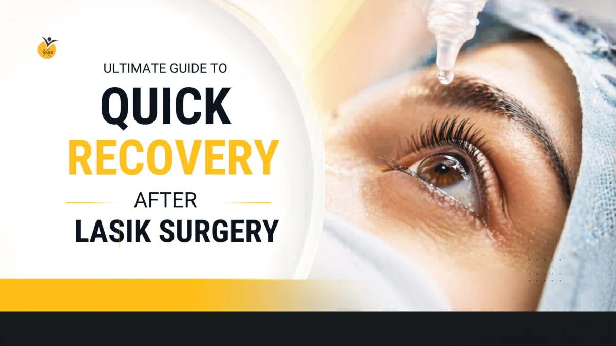 Ultimate Guide to Quick Recovery After LASIK Surgery