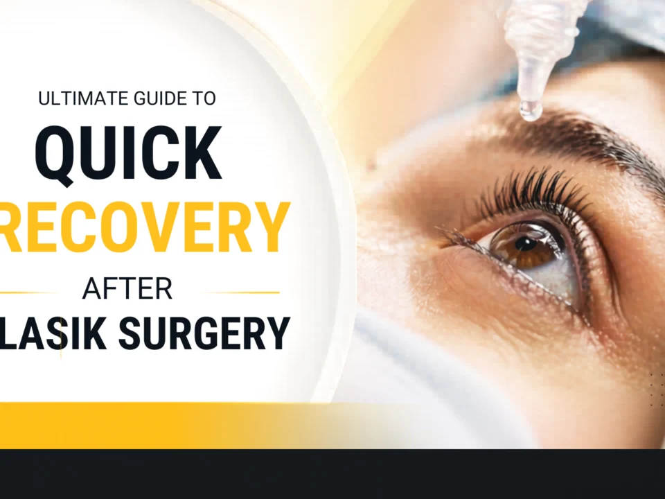 Ultimate Guide to Quick Recovery After LASIK Surgery
