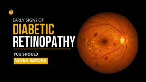 Early Signs of Diabetic Retinopathy You Should Never Ignore