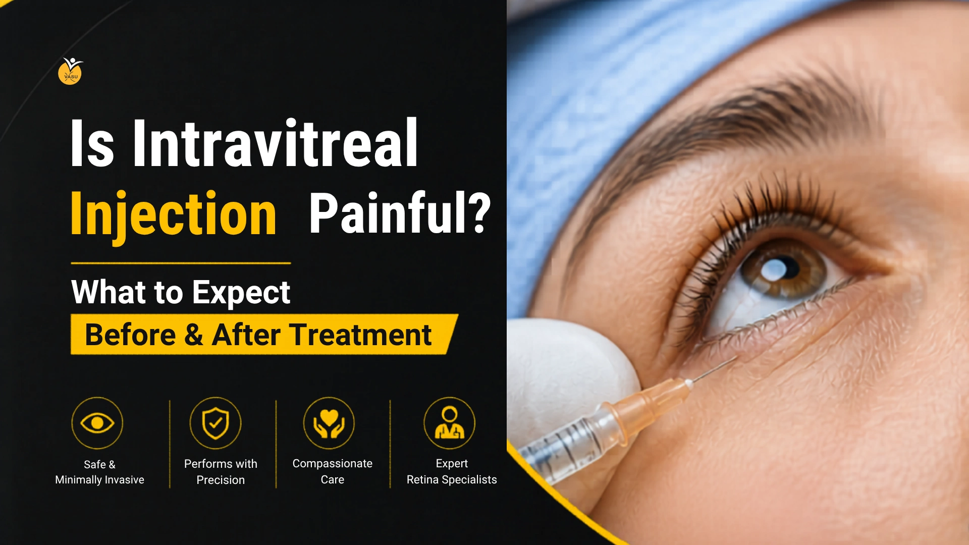 Is Intravitreal Injection Painful? What to Expect Before & After Treatment