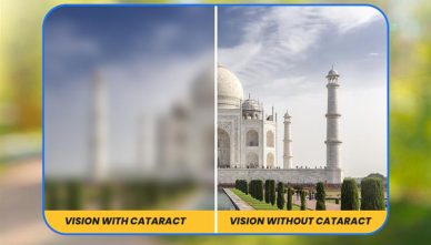 Best Eye Hospital in Bathinda