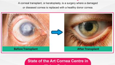 cornea clinic at Best Eye Hospital in Bathinda