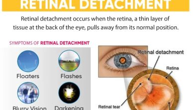 Is Your Vision at Risk? Find Out Why Vasu Eye Institute is the Best for Retina Care!