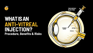 What is an Anti-Vitreal Injection? Procedure, Benefits & Risks