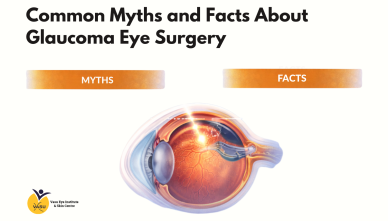 Common Myths and Facts About Glaucoma Eye Surgery
