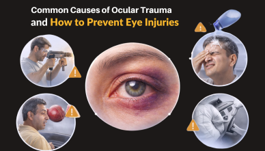 Common Causes of Ocular Trauma and How to Prevent Eye Injuries