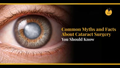 Common Myths and Facts About Cataract Surgery You Should Know