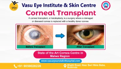 Visiting the nearest cornea clinic in Mukatsar for eye health