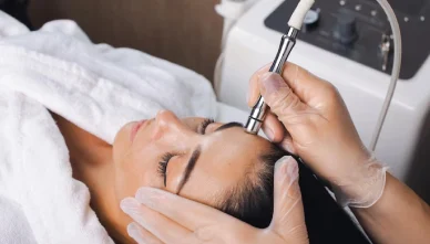 Top 5 Reasons to Get Professional Acne Treatment Instead of DIY Remedies