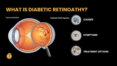 What is Diabetic Retinopathy? Causes, Symptoms & Treatment Options
