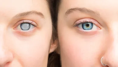 Glaucoma Treatment in Bathinda