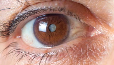 Sign and Symptoms of Cataract Eye: Guide for Early Detection