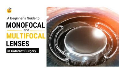 A Beginner’s Guide to Monofocal and Multifocal Lenses in Cataract Surgery