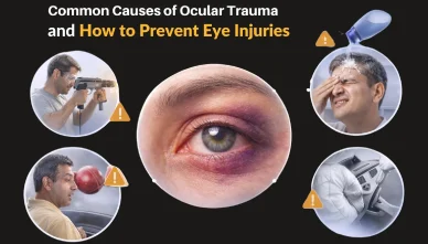 Common Causes of Ocular Trauma and How to Prevent Eye Injuries