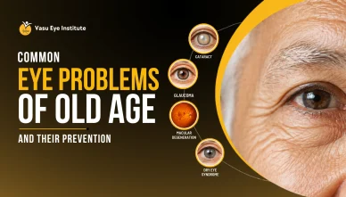 Common Eye Problems of Old Age and Their Prevention