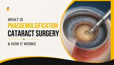 What is Phacoemulsification Cataract Surgery & How It Works