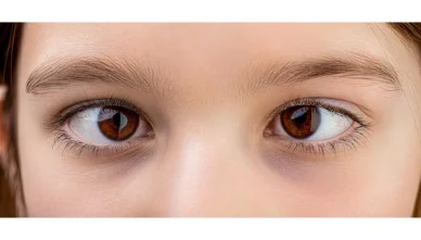 Squint (Cross Eyes) in Children: Causes, Treatment & The Best Age for Surgery in Bathinda
